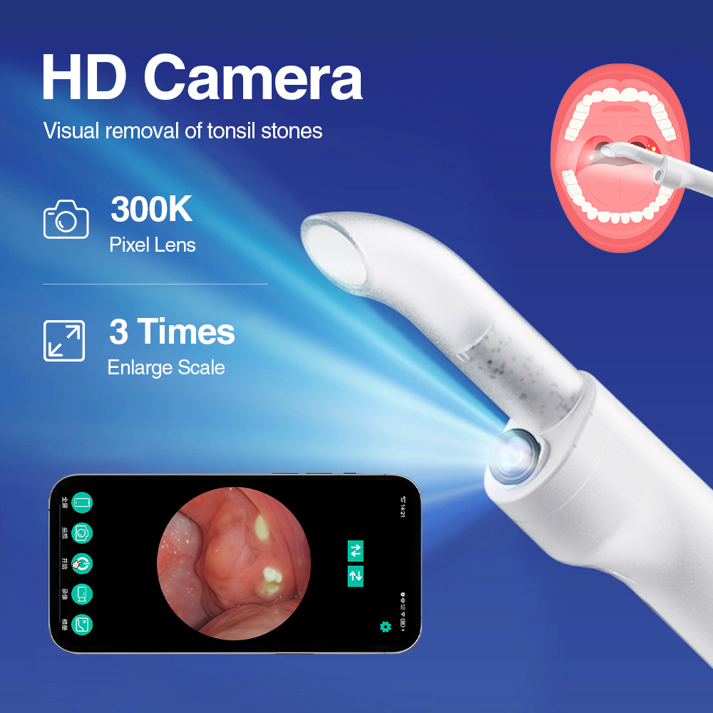 Slimme Visuele Tonsil Stone Re - Lighting Visual recensie en prijs